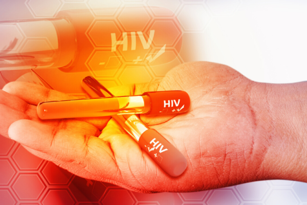 HIV Treatment