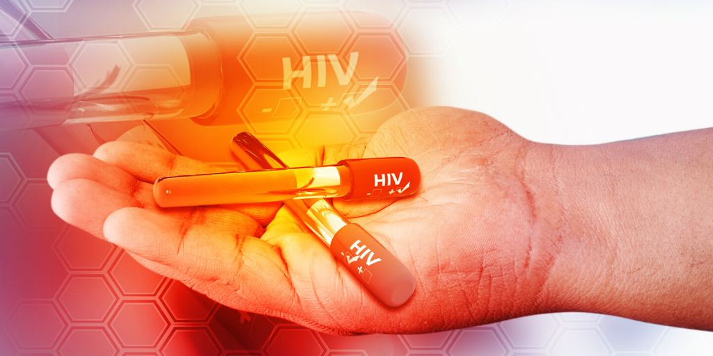 HIV Treatment